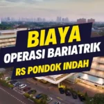 Biaya Operasi Bariatrik di RS Pondok Indah