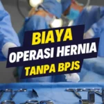 Biaya Operasi Hernia Tanpa BPJS