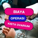 Biaya Operasi Kista Ovarium di Rumah Sakit