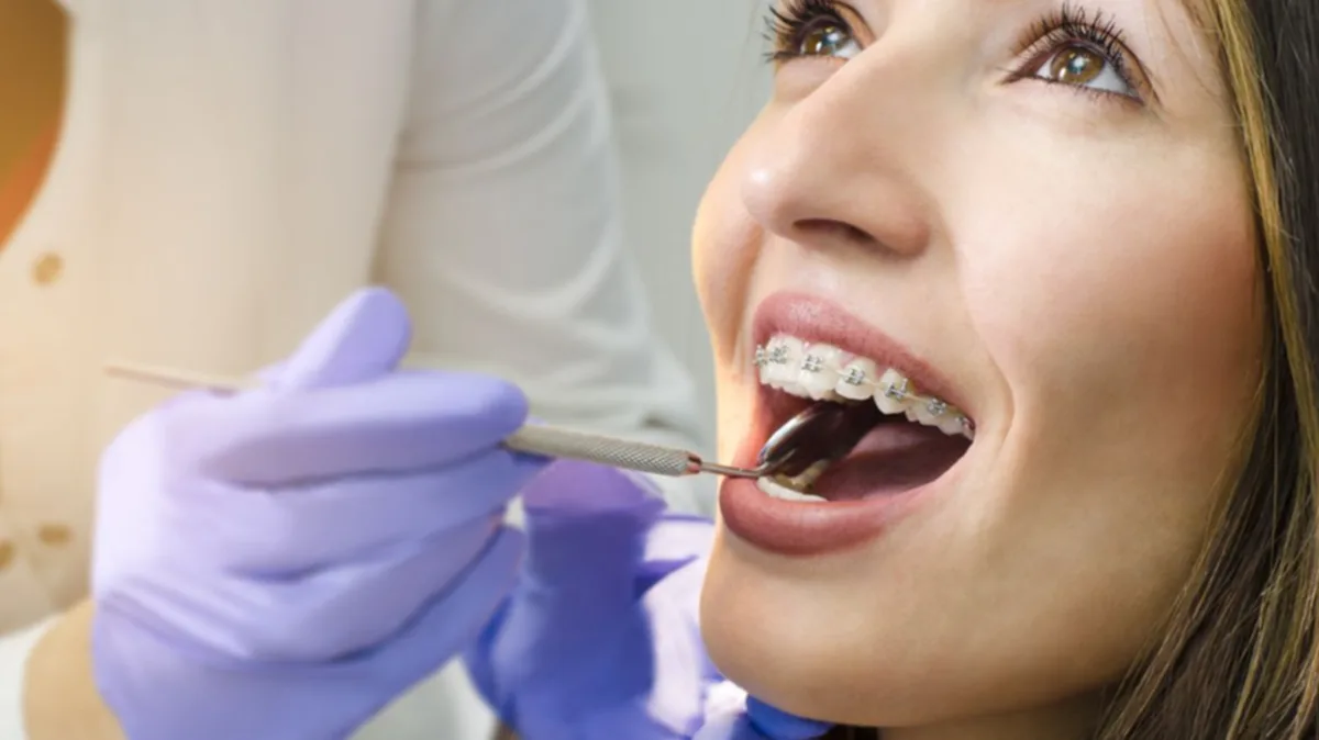 Rincian Biaya Pasang Kawat Gigi di Puskesmas